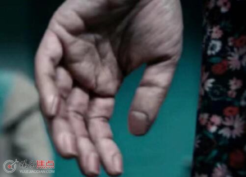 照明商店柳岩指甲反长怎么回事