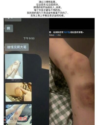 前女友说TT酒后施暴